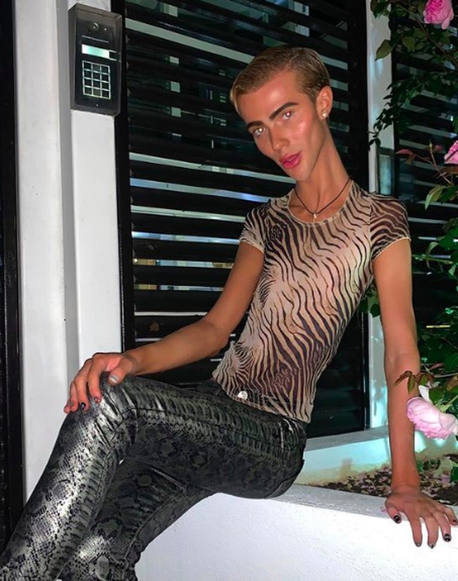 Inilah penampakan tubuh cekingnya. Joey mengaku bahwa kini beratnya hanya 47 kg, padahal dia punya figur yang cukup tinggi yakni 180 cm. Foto: dok. Instagram