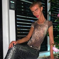 Inilah penampakan tubuh cekingnya. Joey mengaku bahwa kini beratnya hanya 47 kg, padahal dia punya figur yang cukup tinggi yakni 180 cm. Foto: dok. Instagram