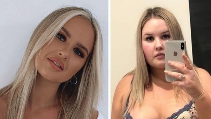 Dulu Makan Junk Food Tiap Hari, Wanita Ini Berhasil Turunkan BB 30 Kg