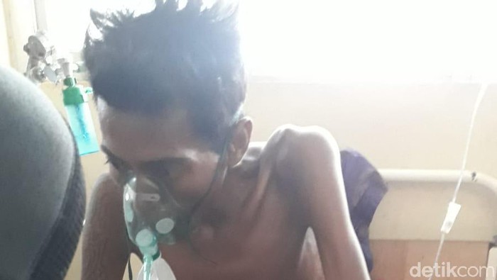 Irfan (37) di Kabupaten Dompu, NTB menderita tumor ganas di perut dan hidup sebatang kara. (Faruk/detikcom)