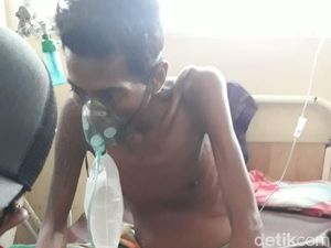 Tolong! Pria di Dompu NTB Alami Tumor Ganas di Perut Hidup Sebatang Kara