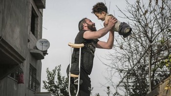 Photo of The Year dianugerahkan pada Mehmet Aslan, Foto ini menampilkan Munzir, kehilangan kaki kanannya saat sebuah bom dijatuhkan saat dia berjalan melewati pasar di Idlib, Suriah. Putranya Mustafa lahir tanpa anggota tubuh bagian bawah atau atas karena tetra-amelia, kelainan bawaan yang disebabkan oleh obat-obatan yang harus diminum ibunya Zeynep setelah sakit oleh gas saraf yang dilepaskan selama perang di Suriah. Foto: Siena International Photo Awards
