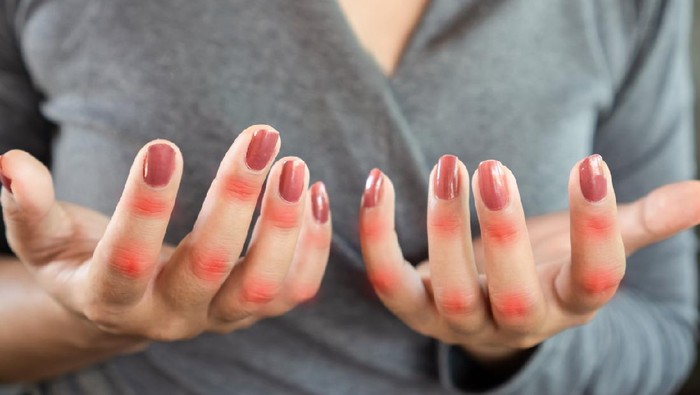 closeup woman suffering from hand and finger pain can be use for knuckle , joint pain and gout concept