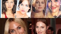 Tapi yang paling mencolok adalah perubahan wajahnya. Meryem Uzerli beberapa kali menjalani operasi rahang. Foto: dok EN Magz