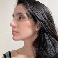 Melalui salah satu unggahan, Sheila Marcia mengungkapkan alasannya menghapus tato di tubuhnya. Sheila menyebut bahwa dirinya memang sengaja menghapus tatonya itu karena hatinya berkata demikian. Dia tidak melakukannya karena alasan orang lain. Foto: Instagram/@itssheilamj