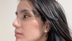 Tubuh Sheila Marcia Penuh Luka Laser Usaha Hapus Tato