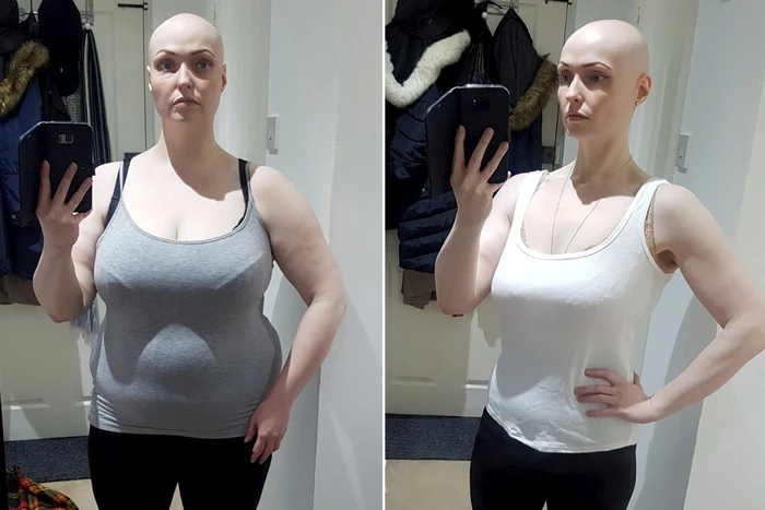 ‘Puasa’ Medsos, Wanita Ini Bisa Turun Berat Badan 36 Kg!