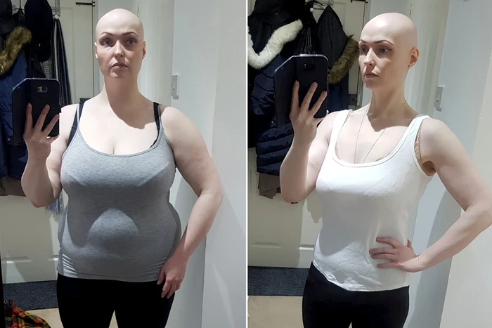 ‘Puasa’ Medsos, Wanita Ini Bisa Turun Berat Badan 36 Kg! ‘Puasa’ Medsos, Wanita Ini Bisa Turun Berat Badan 36 Kg!