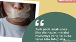 Tidur dengan Mulut Diselotip, Jadi Lebih Nyenyak? Ini Faktanya