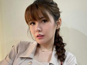 Cerita Lengkap Angela Lee Soal Implan Jebol Pasca Operasi Hidung
