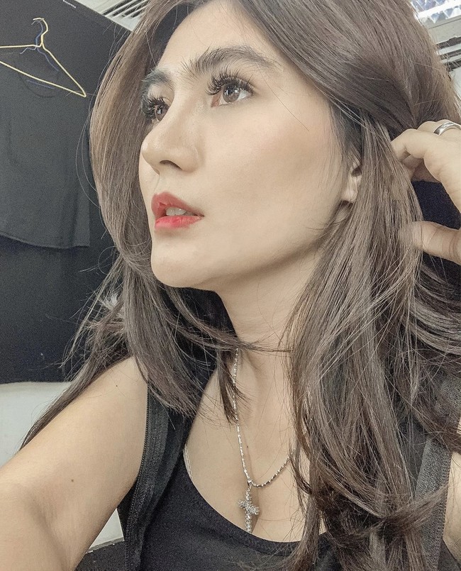 Pada Maret 2021 lalu, artis Angela Lee terang-terangan mengaku telah menjalani operasi plastik hidung. Sambil memperlihatkan foto hidungnya yang masih diperban, Angela mengatakan bahwa dia melakukan bedah plastik untuk memperbaiki hidungnya yang miring. Namun di November, Angela Lee mengabarkan bahwa implannya jebol, bahkan hampir menembus ke kulitnya. Dia harus kembali menjalani operasi untuk memperbaiki implannya yang jebol. Foto: Dok. Instagram @angelalee87.