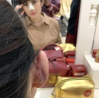 Karena kulit aku teksturnya tipis jadi jaringan kulit yang jebol mesti ditambahin tulang rawan... dan dijahit yang jebolnya kalo didiemin ntar bisa infeksi.....😢😢😢, kata Angela. Foto: Dok. Instagram @angelalee87.