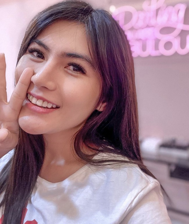 Dikonfirmasi Wolipop, Angela Lee membenarkan dirinya mengalami implan jebol setelah operasi hidung. Dia saat ini sedang menjalani proses pemulihan. Foto: Dok. Instagram @angelalee87.