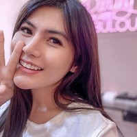 Dikonfirmasi Wolipop, Angela Lee membenarkan dirinya mengalami implan jebol setelah operasi hidung. Dia saat ini sedang menjalani proses pemulihan. Foto: Dok. Instagram @angelalee87.