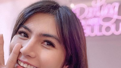 8 Foto Penampakan Angela Lee yang Implannya Jebol Setelah Operasi Hidung