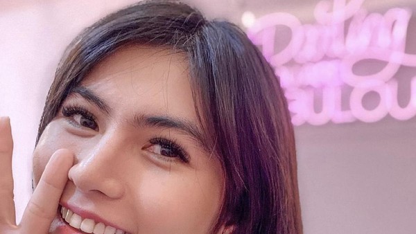 8 Foto Penampakan Angela Lee yang Implannya Jebol Setelah Operasi Hidung
