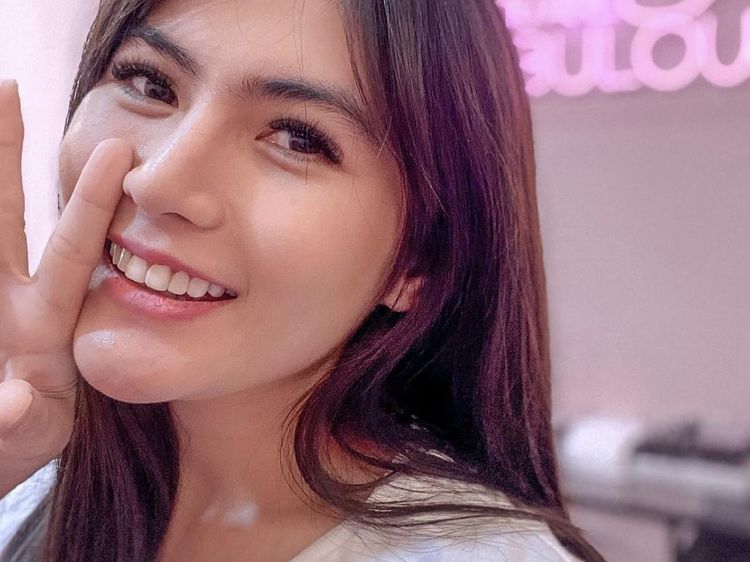 8 Foto Penampakan Angela Lee yang Implannya Jebol Setelah Operasi Hidung