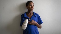 Haftom Gebretsadik (17) kehilangan tangan kanan akibat tertembak di rumahnya, di Ethiopia utara, (6/5). Juru bicara pemberontak, Getachew Reda mengatakan TPLF yang mendominasi politik nasional selama tiga dekade hingga 2018, tidak memiliki motif lain selain menerobos pengepungan mematikan di Tigray, yang mengalami krisis dalam pergolakan.