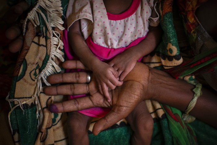 Konflik bersenjata masih terlihat di negara miskin di tanduk Afrika, Ethiopia. Lebih dari 10 bulan masih berseteru dan menyisakan cerita getir. Berikut sejumah foto-fotonya: