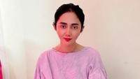 Sebelumnya, Aida Saksia menjalani 4 kali operasi kanker payudara. Foto: Instagram Aida Saskia