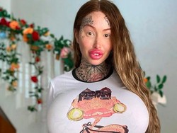 8 Penampilan Ngeri Model yang Hobi Oplas, Implan Dada Sampai Vagina