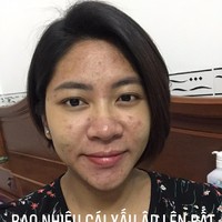 Dang Thu Thao mengandung anak kembar dari pernikahannya. Berat badannya naik lebih dari 20 kg saat hamil. Penampilan wajahnya pun berubah menjadi berjerawat akibat hormon di tubuhnya. Foto: Dok. Facebook Dang Thu Thao