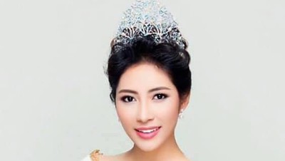 Foto Ratu Kecantikan Ngaku Diselingkuhi Suami karena Jerawatan Saat Hamil