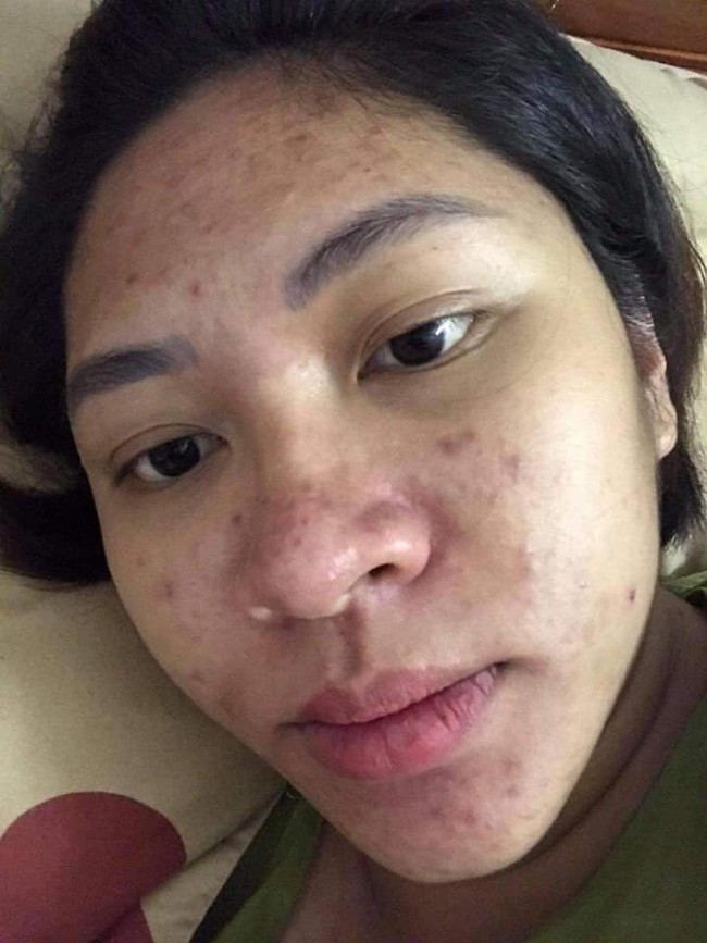 “Aku mendapatkan penampilan yang buruk untuk melihat seberapa setia suamiku. Hingga ada orang ketiga yang meneror kesehatan mentalku setiap hari. Suamiku bukannya melindungiku, aku malah dipermalukan karena penampilan burukku. Aku tidak pernah akan melupakan bagaimana rasanya dipukuli oleh suamiku,” curhatnya di Facebook. Foto: Dok. Facebook Dang Thu Thao