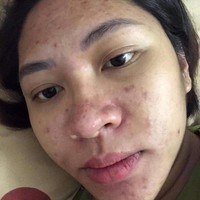 “Aku mendapatkan penampilan yang buruk untuk melihat seberapa setia suamiku. Hingga ada orang ketiga yang meneror kesehatan mentalku setiap hari. Suamiku bukannya melindungiku, aku malah dipermalukan karena penampilan burukku. Aku tidak pernah akan melupakan bagaimana rasanya dipukuli oleh suamiku,” curhatnya di Facebook. Foto: Dok. Facebook Dang Thu Thao