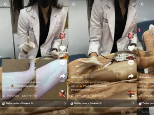 Viral Korban Hand Body Palsu, Waspada Kandungan Ini di Krim Pemutih