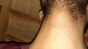 Ini ketika memotret dengan angle dagu ketika kepala diarahkan ke atas. Foto: Reddit via Brightside