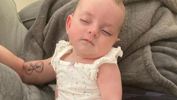 Balita ini seperti punya tangan yang ditato. Foto: Reddit via Brightside