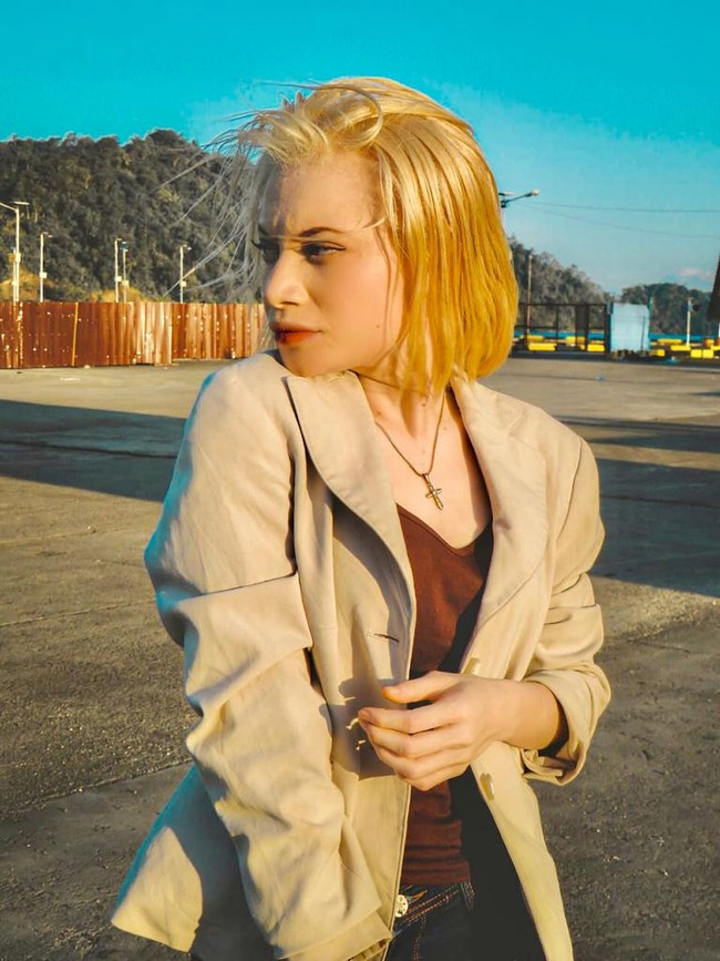 Kini dirinya viral, Lena ingin memberikan semangat dan membuktikan jika wanita albino bisa berprestasi dan menghasilkan karya. Menurutnya kondisi fisik seseorang janganlah jadi penghalang untuk meraih cita-cita. Kita tidak pernah bisa meminta mau dilahirkan di keluarga mana dan dalam kondisi fisik yang seperti apa. Tapi satu hal yang harus kalian percayai bahwa Tuhan menciptakan kita itu ada maksud dan tujuannya. Tuhan tidak pernah menciptakan manusia hanya dengan kekurangannya saja, pasti ada kelebihannya, ucap Lena dengan ramah. Foto: Dok. pribadi Herolena Beroperay.