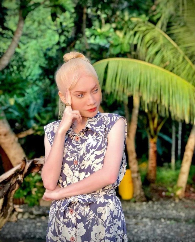 Anak pertama dari tujuh bersaudara ini mengaku jika warganet tidak percaya jika ia merupakan penduduk asli Papua. Hingga ia mengeluarkan bukti foto keluarga. Saya pernah mengalami hal yang kurang menyenangkan. Ketika banyak orang tidak percaya bahwa saya asli Papua. Tapi saya tetap meyakinkan mereka dengan menunjukkan foto keluarga atau menunjukkan orangtua saya kepada mereka, jelasnya geram. Foto: Dok. Instagram @herolenacrionsa.