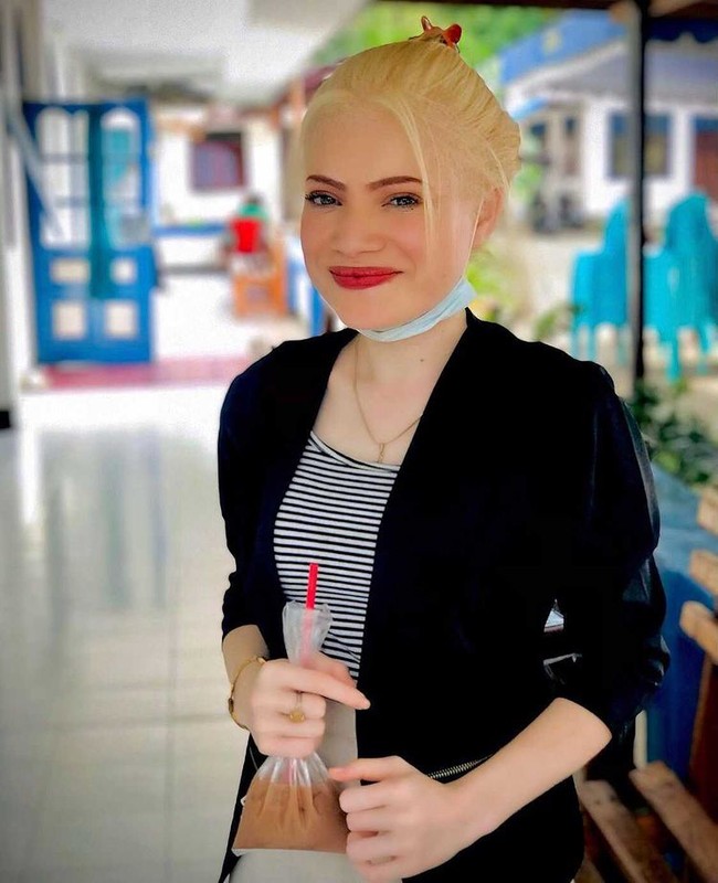 Wanita 21 tahun itu mengungkapkan jika ia adalah seorang albino. Ya saya seorang albino karena beberapa tanda-tanda fisik orang albino ada pada saya, ucapnya. Namun kondisi tersebut tidak membuatnya minder. Dia malah semakin percaya diri dan mengasah segala potensi yang ada di dalam dirinya. Dan membuat kedua orangtuanya bangga atas prestasinya. Lena mengungkapkan kegiatan sehari-harinya saat ini adalah kuliah. Selain itu ia juga berbisnis online untuk mengisi waktu luangnya. Foto: Dok. Instagram @herolenacrionsa.