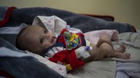 Diketahui, kasus anak-anak di Afghanistan yang mengalami gizi buruk kian bertambah akibat krisis ekonomi yang melanda negara tersebut.
