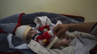 Jutaan warga Afghanistan kini sangat bergantung pada bantuan pangan dari organisasi internasional seperti World Food Program (WFP). Sementara itu, WFP sendiri dihadapkan pada keharusan untuk meningkatkan pasokannya ke Afghanistan untuk membantu lebih dari 22 juta orang. Bantuan pangan itu menjadi salah satu upaya bagi warga di negara tersebut dapat bertahan hidup di tengah krisis kemanusiaan serta cuaca buruk akibat perubahan iklim yang melanda dunia.