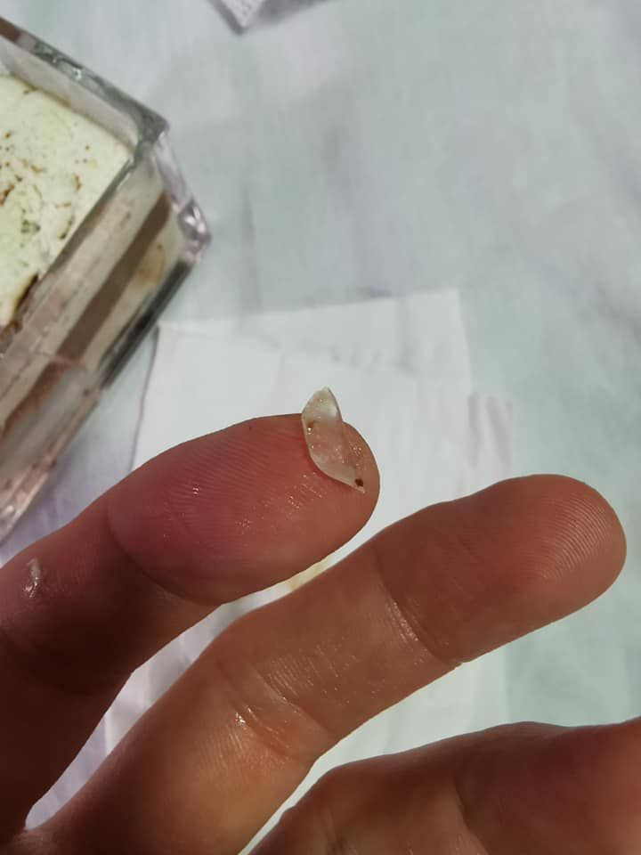 Ngeri! Lidah Pria Ini Tergores Kaca Saat Asyik Ngemil Tiramisu