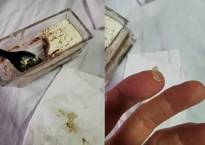 Ngeri! Lidah Pria Ini Tergores Kaca Saat Asyik Ngemil Tiramisu Ngeri! Lidah Pria Ini Tergores Kaca Saat Asyik Ngemil Tiramisu