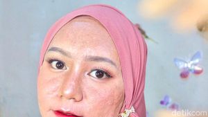 Kisah Beauty Influencer Berjerawat, 9 Tahun Jadi Acne Fighter