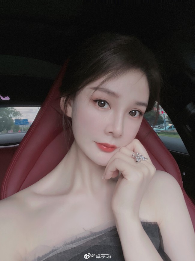 Dikabarkan jika Zhou Hengyu memang berusaha untuk tampil secantik Yang Mi dengan melakukan serangkaian operasi plastik. Netizen berspekulasi bahwa ia menghabiskan enam tahun untuk meniru fitur wajah aktris populer tersebut.Foto: Weibo Zhou Hengyu