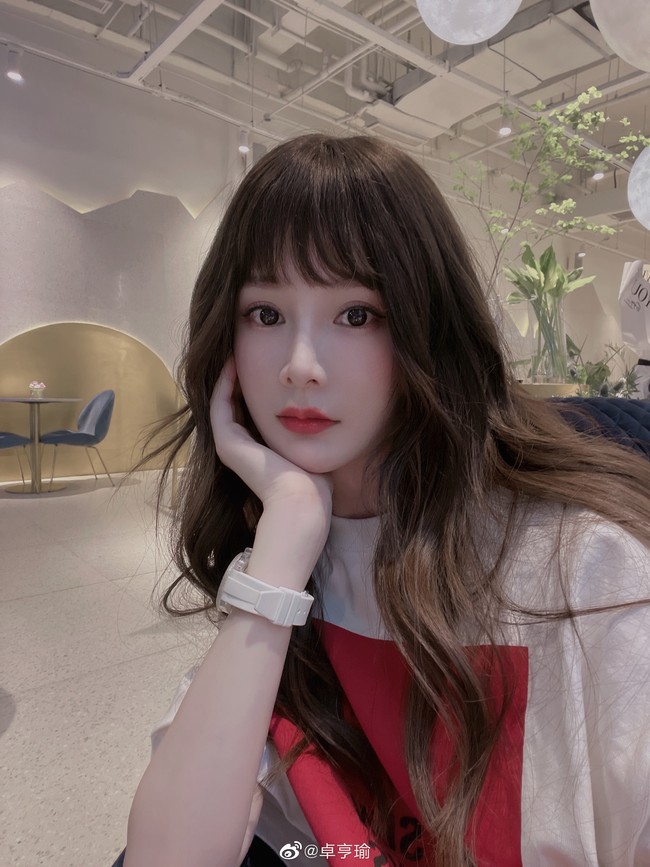 Setelah mengubah penampilannya, Zhou Hengyu dikatakan melabeli dirinya sendiri sebagai Yang Mi kecil karena berusia lebih muda dari sang aktris. Wanita yang awalnya berprofesi sebagai model itu kemudian mendapat banyak tawaran iklan hingga akhirnya menjadi pemeran pengganti aktris tersebut.Foto: Weibo Zhou Hengyu