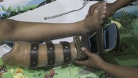 Kaki palsu yang diproduksi di Bekasi itu telah dipasarkan secara nasional. 