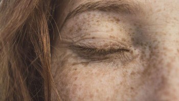 Ada tungau wajah yang hidup di dalam pori-pori di sebelah folikel rambut. Dia memakan sebum, tidak memiliki anus dan keluar pada malam hari untuk kawin. Foto: Reddit via Bored Panda