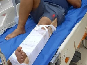 Iptu Lukas, Polisi yang Dilindas Bandar Narkoba di Cirebon Jalani Operasi