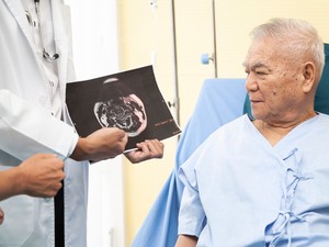 Bisakah Parkinson Diatasi dengan Pembedahan? Ini Penjelasan Dokter