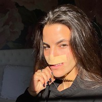 Model dan skater Brooklinn Khoury mengisahkan bahwa dia diserang anjing pada 2020 silam. Anjing berjenis pitbull itu milik salah satu keluarganya. Dengan brutal anjing tersebut merobek bibir Brooklinn hingga seluruh bibir bagian atasnya putus. Foto: dok. Instagram/@brookhoury