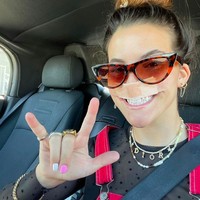 Prosedur tersebut disebut sebagai cangkok kulit. Di mana pengerjaannya cukup kompleks, dan tidak hanya sekali operasi. Operasi plastik tersebut butuh setidaknya lima kali operasi lanjutan. Foto: dok. Instagram/@brookhoury