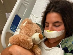 8 Foto Penampakan Model yang Tak Punya Bibir Setelah Diserang Anjing Pitbull