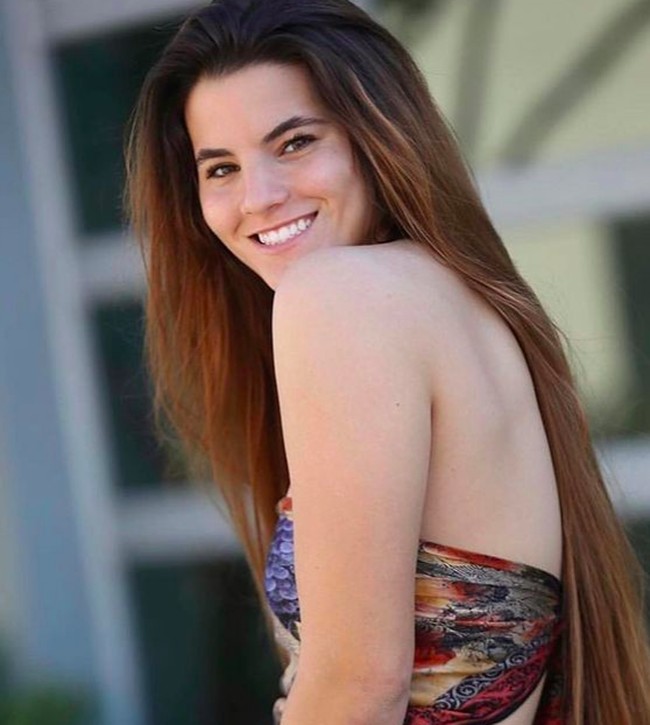 Brooklinn akan segera mendapatkan bibir bagian atasnya kembali. Meski begitu, setelah operasi bentuk bibirnya pun tidak akan kembali normal. “Itu tidak menjadikan bibir hanya sempurna. Itu hanya sebagai fondasi,” ucapnya. Foto: dok. Instagram/@brookhoury